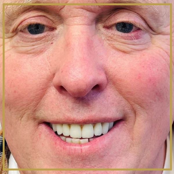Geoffs Implant Journey