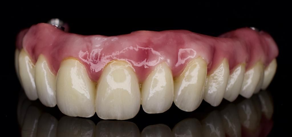 Mike's Teeth