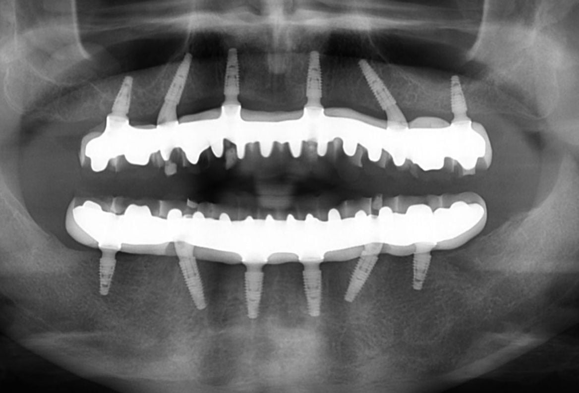 Mike's Xray