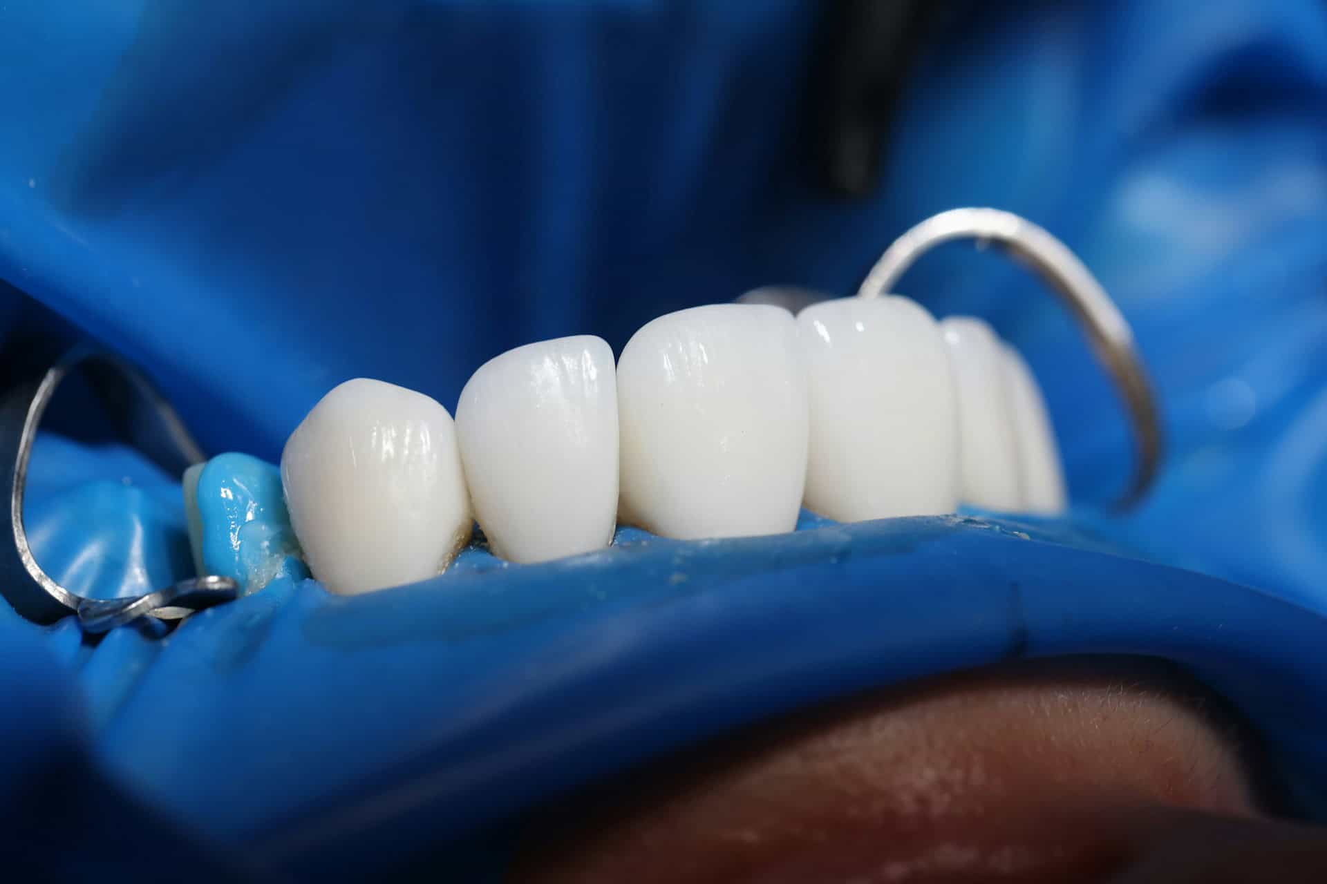 cosmetic dentistry