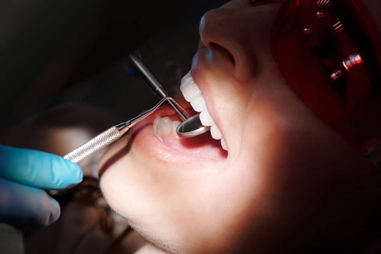 dental implants